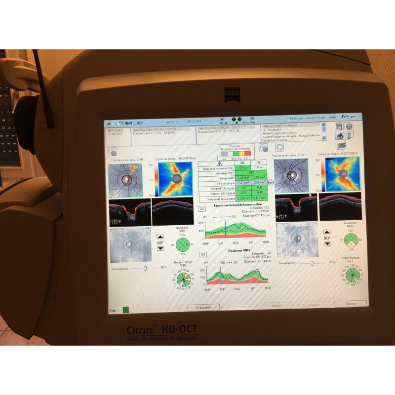 Zeiss Cirrus Hd Oct 4000 Quad Core